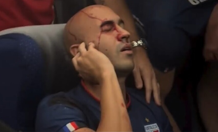 Após o atentado contra a delegação do Fortaleza, o Botafogo-PB faz uma solicitação ao Ministério Público